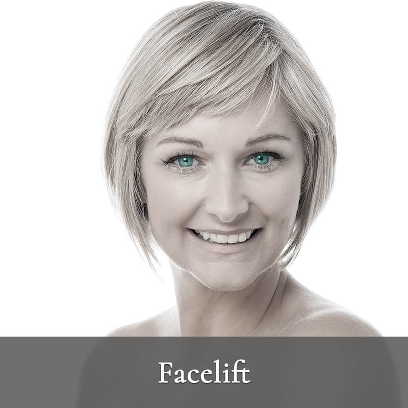 Face Lift